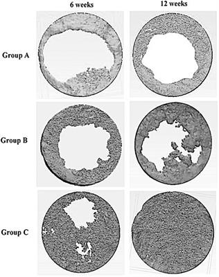 Analysis on Efficacy of Chitosan-Based Gel on Bone Quality and Quantity